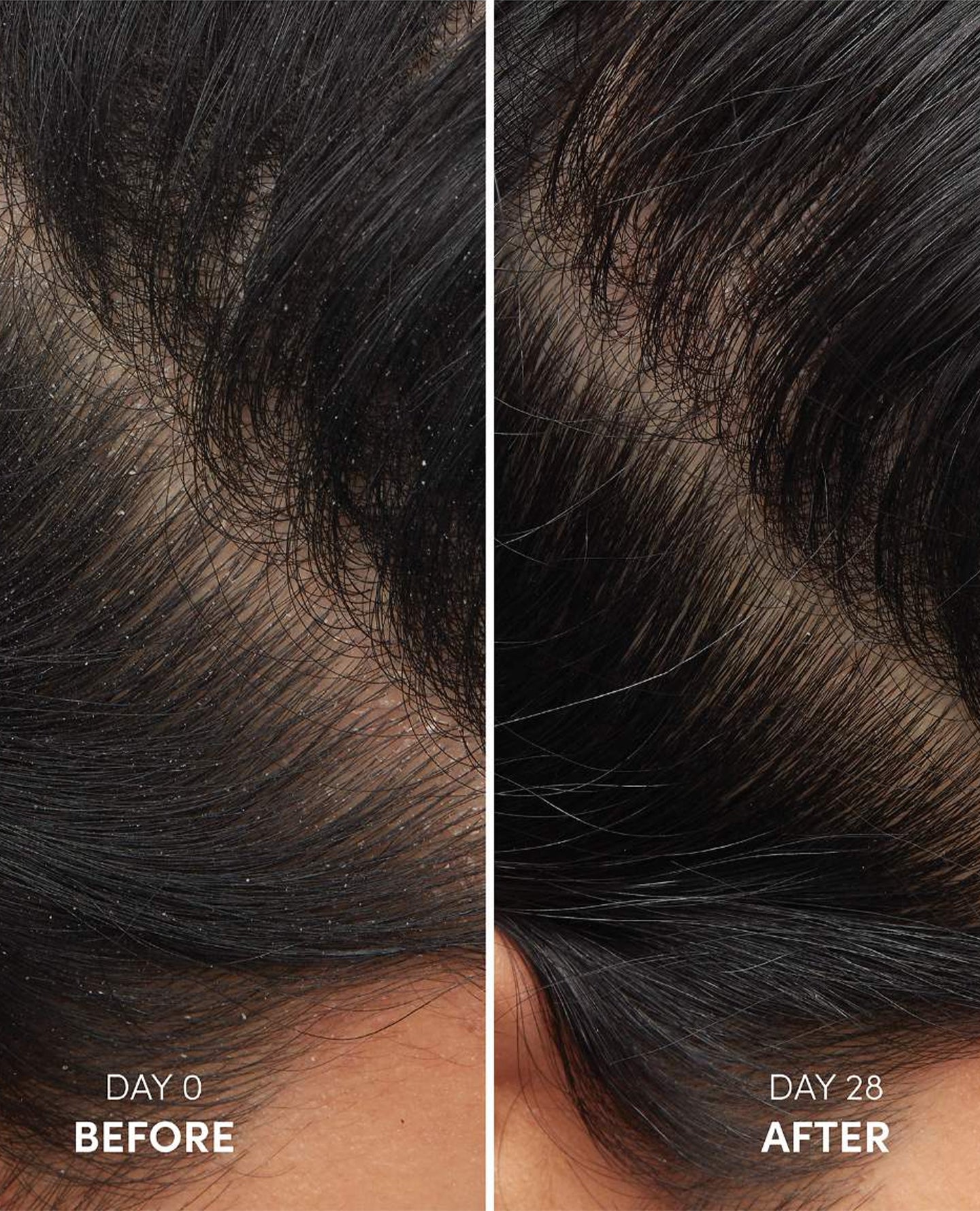 Anti-Dandruff Hair Shampoo - Image 3