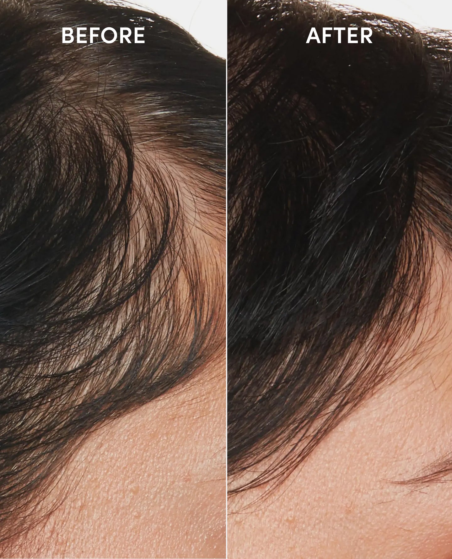Scalp Serum - Image 3