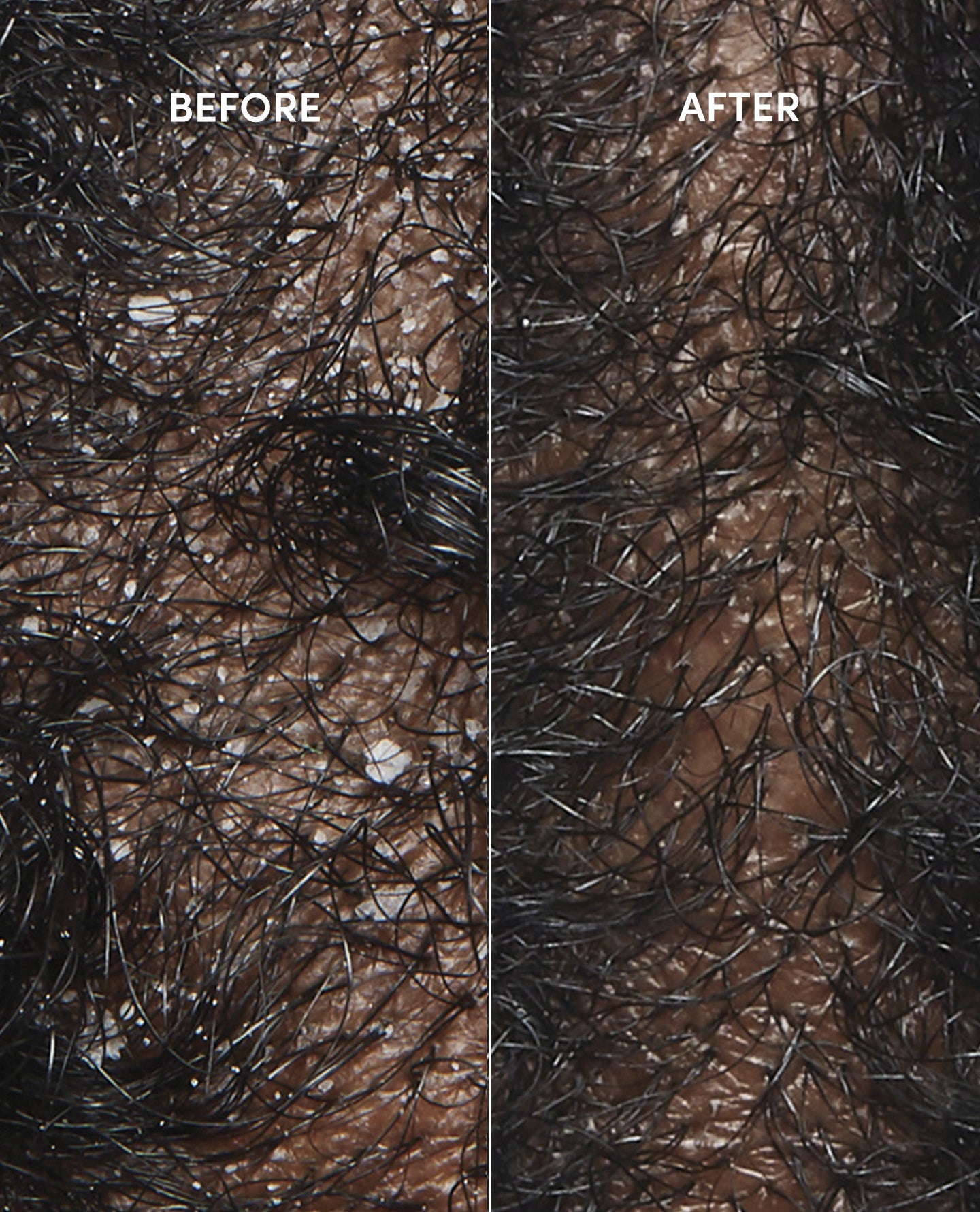 Anti-Dandruff Hair Shampoo - Image 4
