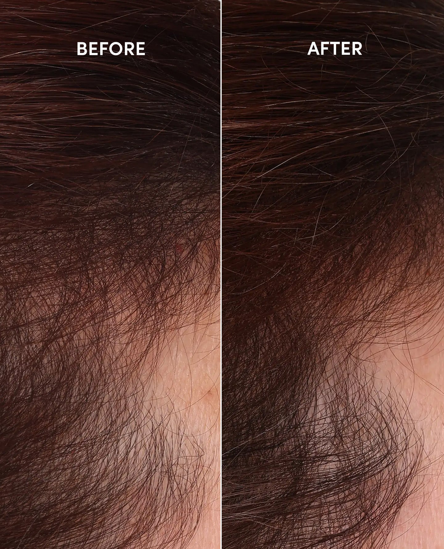 Scalp Serum - Image 4